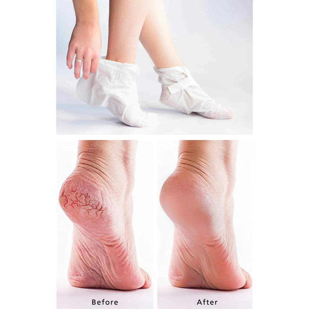 MEDIHEAL Paraffin Foot Sheet Mask